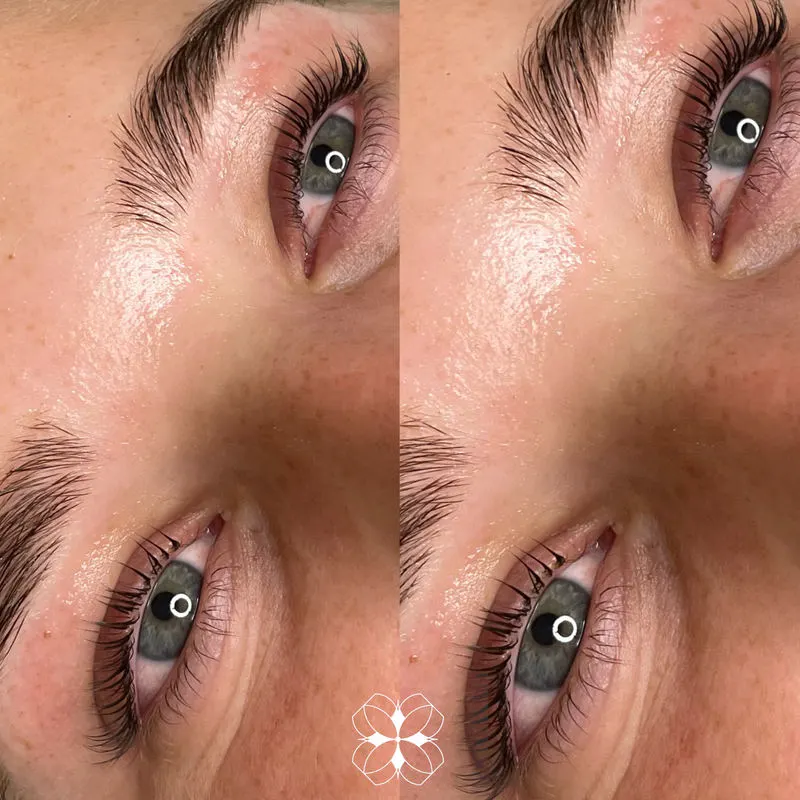 Hybrid lash set